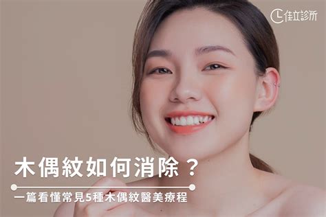 木偶紋|木偶紋是什麼？4種消除木偶紋方法分享：按摩、醫美